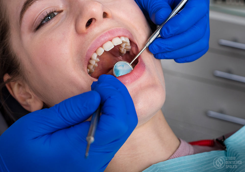 Cura delle Gengive - Studio Dentistico Spoleti